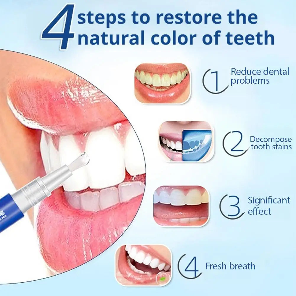 Teeth Whitening Gel Pen Bleach Tooth Dental- NobleWhite
